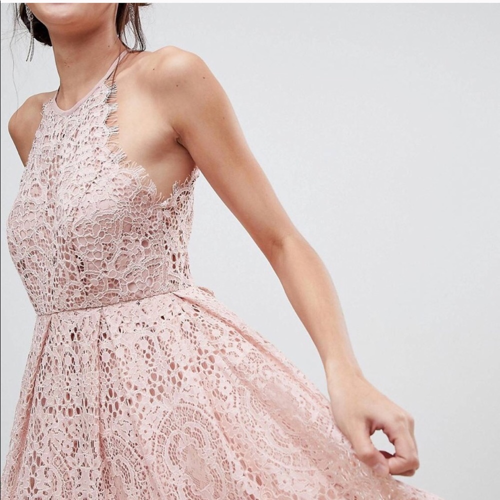 ASOS Scallop Lace Dress